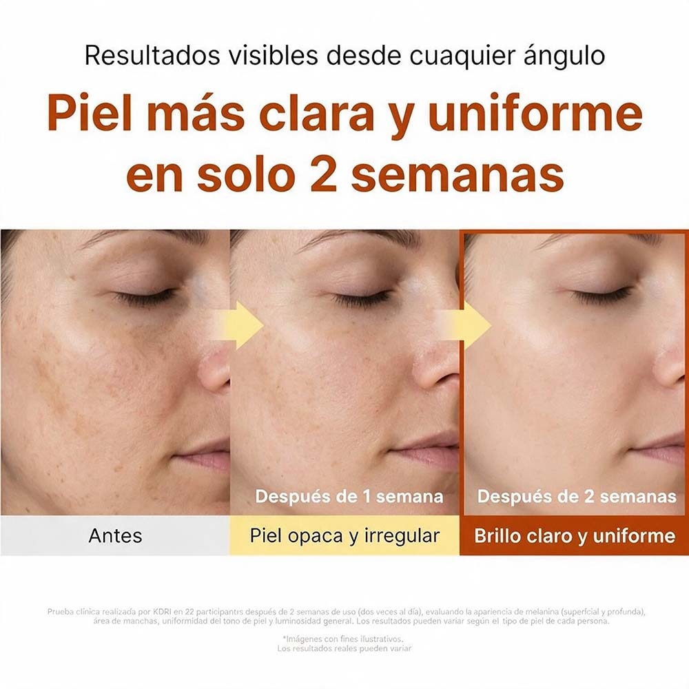 KOJIC ACID NIACINAMIDE BRIGHTENING CAPSULE CREAM (CREMA FACIAL C&Aacute;PSULA ILUMINADORA CON &Aacute;CIDO K&Oacute;JICO)